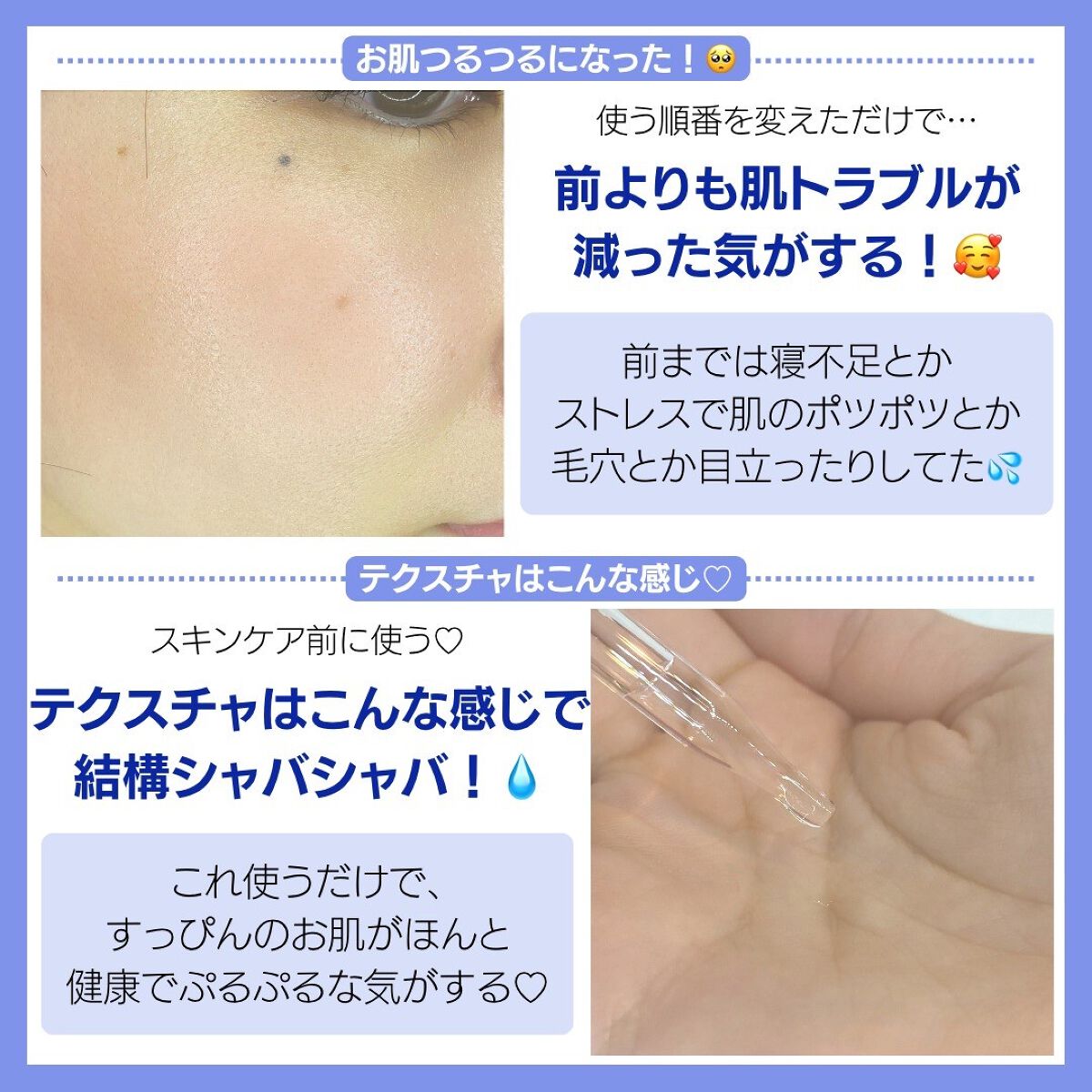 タカミスキンピール/タカミ/ブースター・導入液を使ったクチコミ(5枚目)