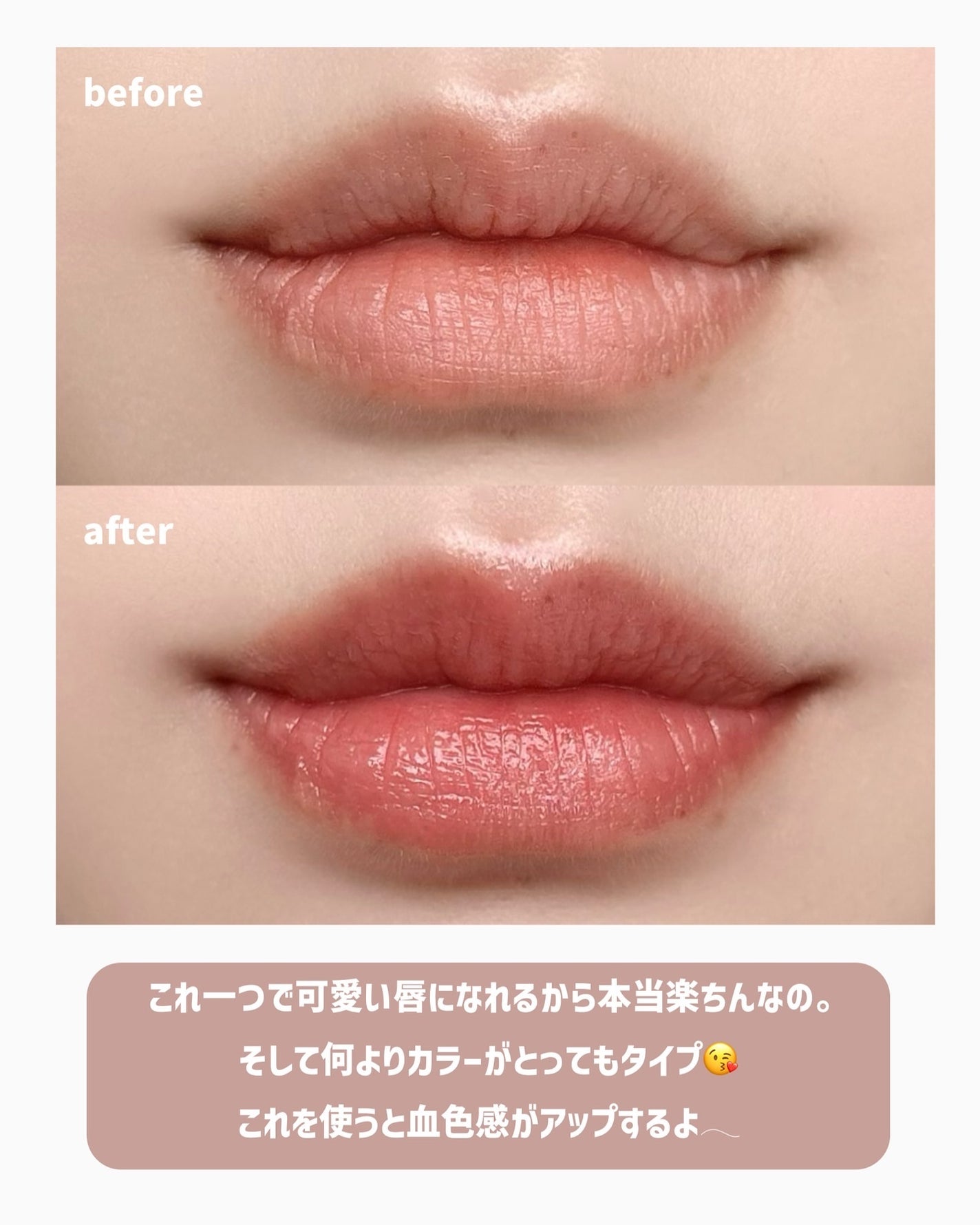 ニードルプランパー 高熱フィグ/Ui2./リッププランパーを使ったクチコミ(4枚目)