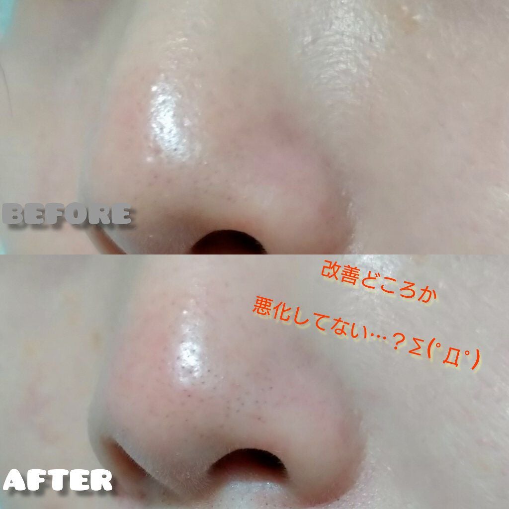 毛穴汚れ分解ジェルプラス/ツルリ/その他洗顔料を使ったクチコミ(3枚目)