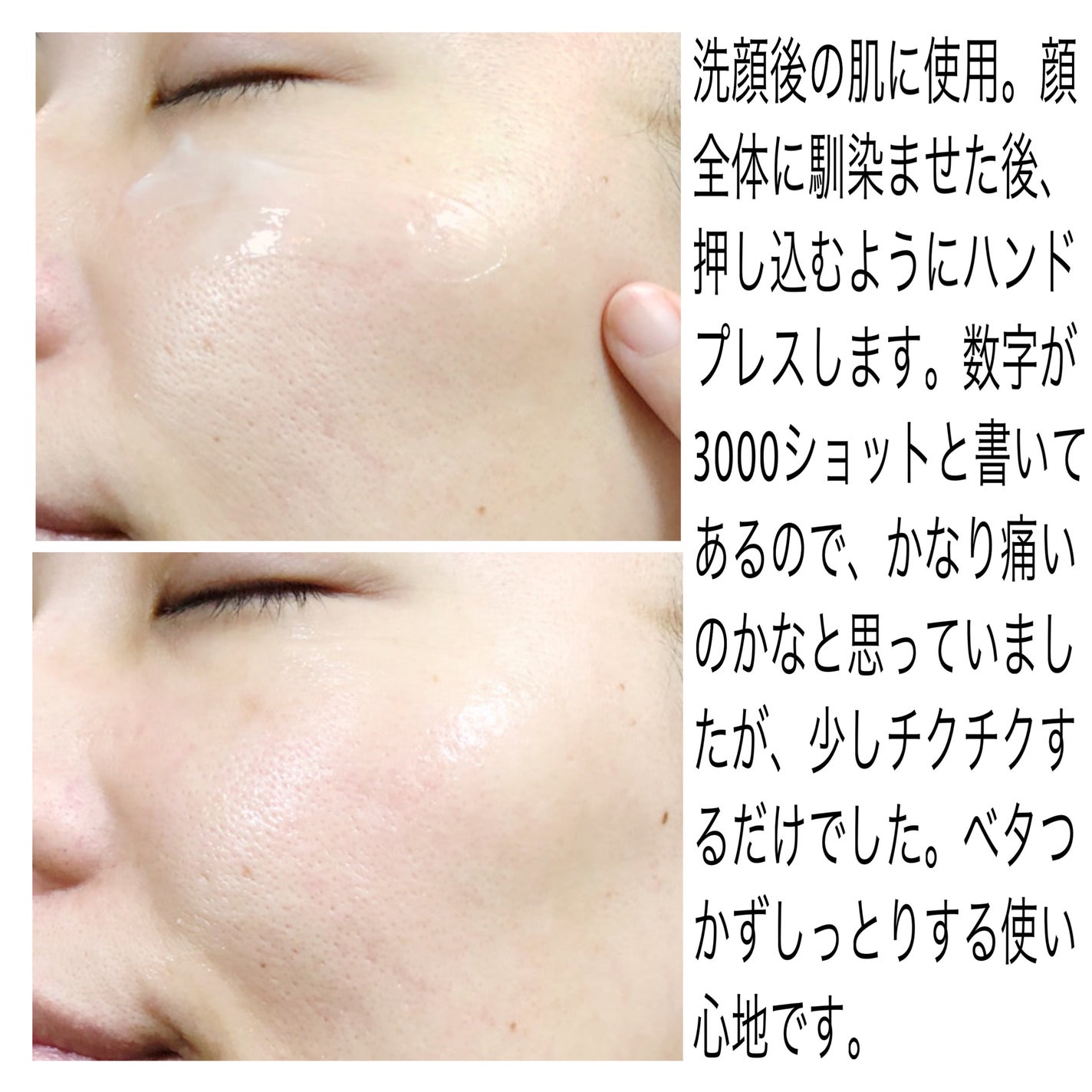 RTXセラム ぺプチショット/Dr.G/美容液を使ったクチコミ(3枚目)