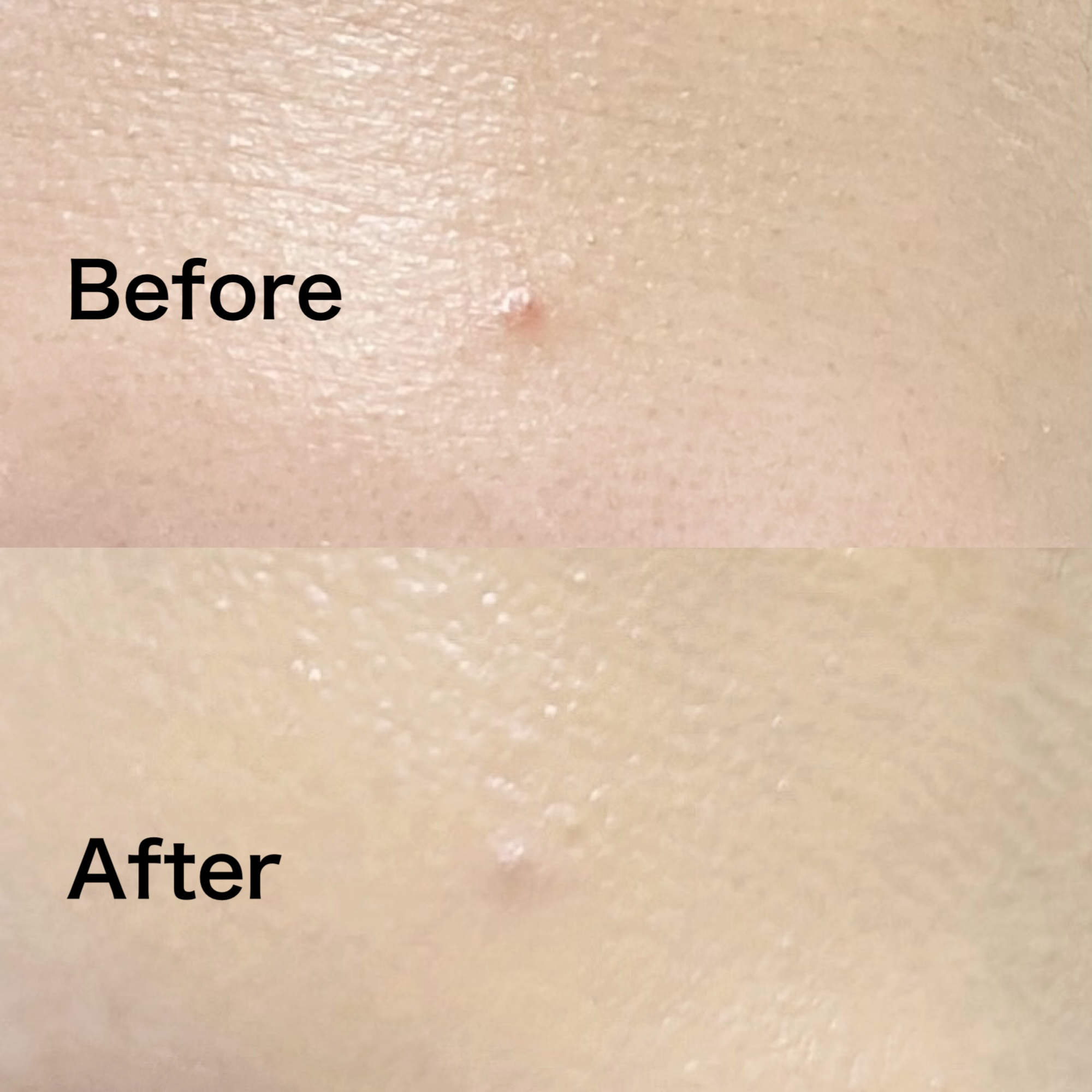 インテグレート プロフィニッシュクッション 1 オークル/インテグレート/クッションファンデーションを使ったクチコミ（3枚目）