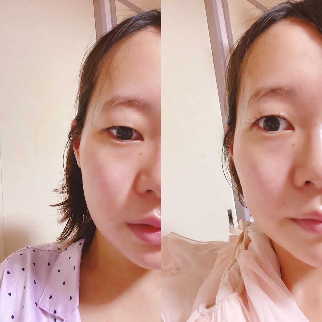 プラセンタファイン/ヴィジョンステイト/美容サプリメントを使ったクチコミ（3枚目）