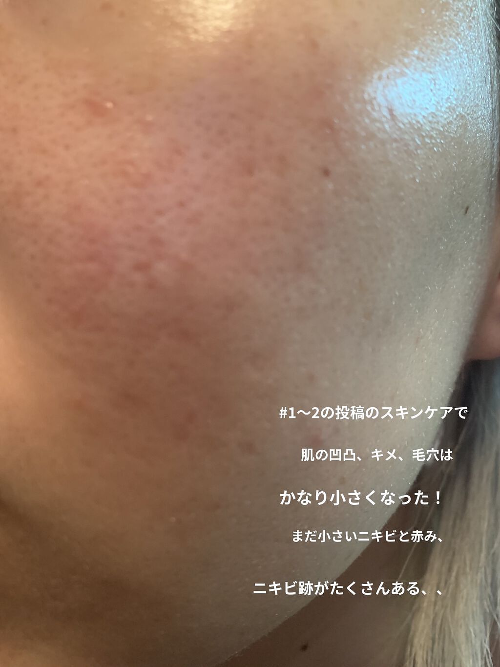 グリーンダーマCICA デイリーシートマスク/ネイチャーリパブリック/シートマスク・パックを使ったクチコミ（2枚目）