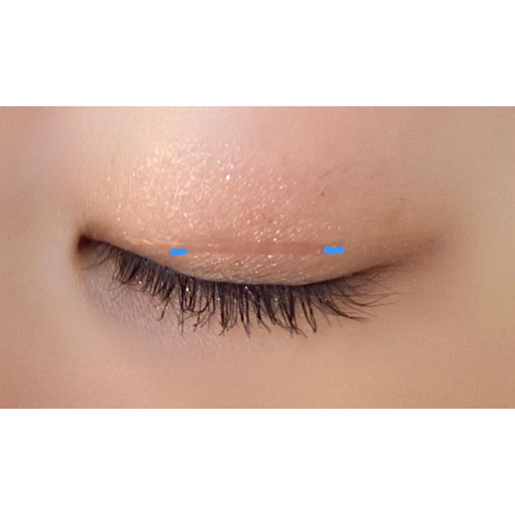 のびーるアイテープ(絆創膏タイプ、レギュラー)/DAISO/二重まぶた用アイテムを使ったクチコミ(3枚目)