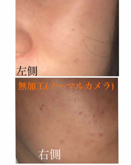 薬用しみ対策 美白化粧水/メラノCC/化粧水を使ったクチコミ(1枚目)