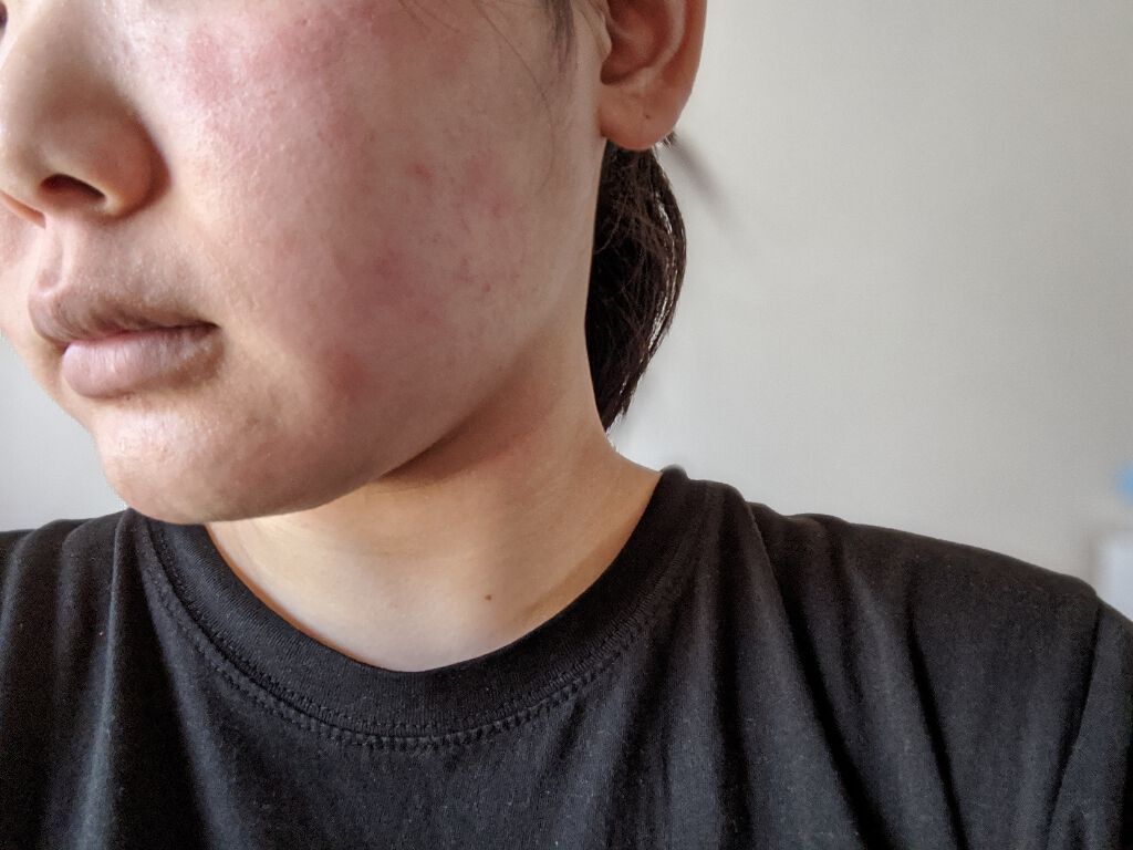 ハトムギ化粧水(ナチュリエ スキンコンディショナー R )/ナチュリエ/化粧水を使ったクチコミ（2枚目）