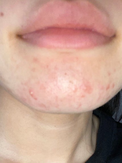 CICA クリーム/VT/フェイスクリームを使ったクチコミ(3枚目)