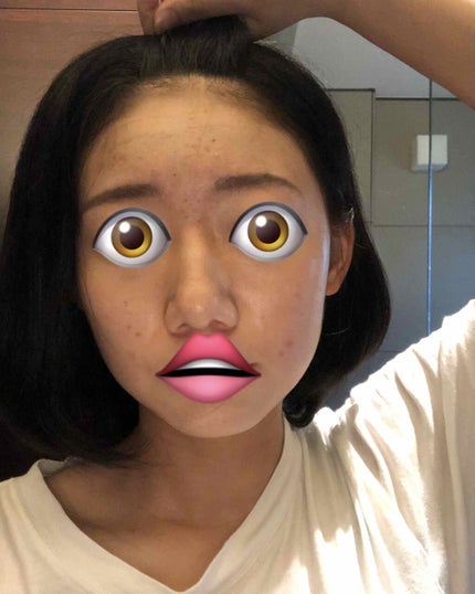 薬用 しみ 集中対策 美容液/メラノCC/美容液を使ったクチコミ(1枚目)