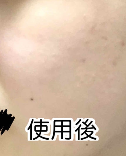 桜雪の雫。/Shiro no Sakura./美容サプリメントを使ったクチコミ(3枚目)