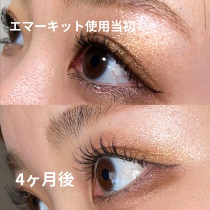 スカルプD ボーテ ピュアフリーアイラッシュセラム/アンファー(スカルプD)/まつげ美容液を使ったクチコミ(1枚目)