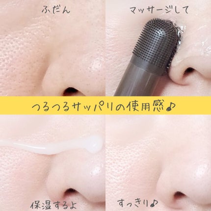 チョコブラ スペシャル毛穴ケアセット/Chocobra/スキンケアキットを使ったクチコミ(5枚目)