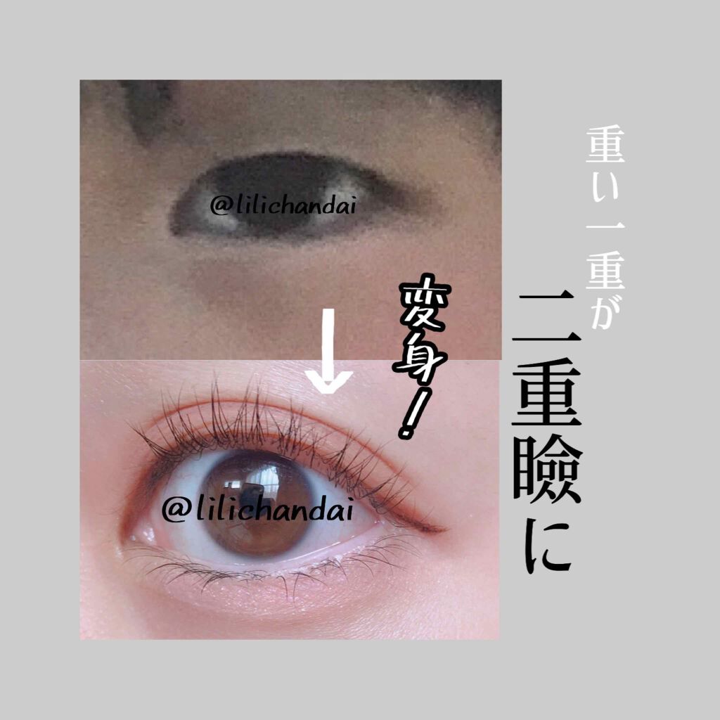 アイトーク/アイトーク/二重まぶた用アイテムを使ったクチコミ（1枚目）