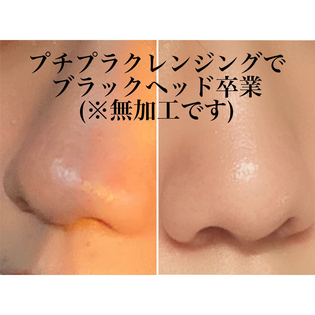 ソフティモ クリアプロ 酵素クレンジングオイル/ソフティモ/オイルクレンジングを使ったクチコミ（1枚目）