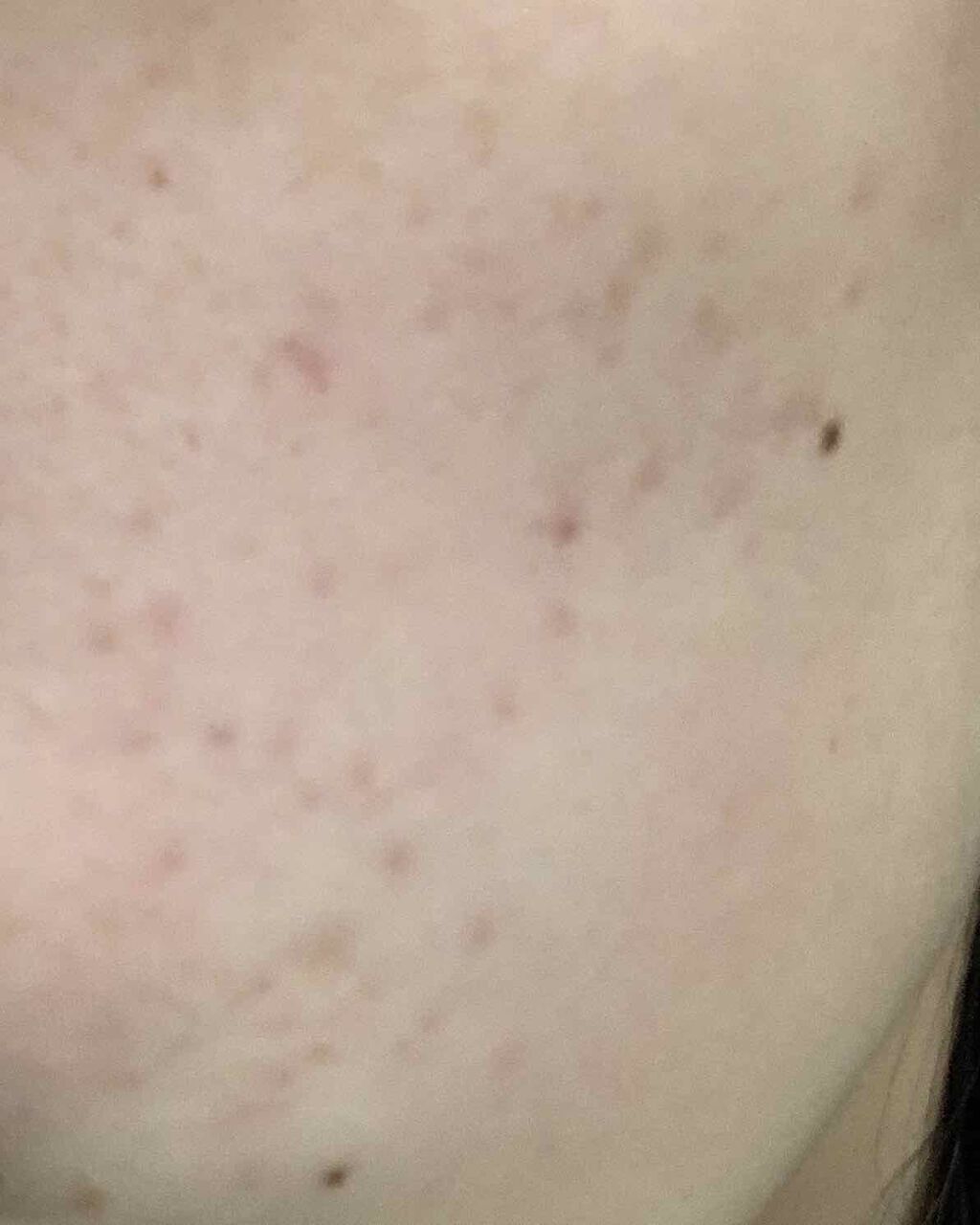 AHA·BHA·PHA 30デイズミラクルトナー/SOME BY MI/化粧水を使ったクチコミ（3枚目）