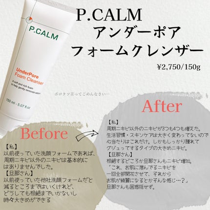 アンダーポアフォームクレンザー/P.CALM/洗顔フォームを使ったクチコミ(2枚目)