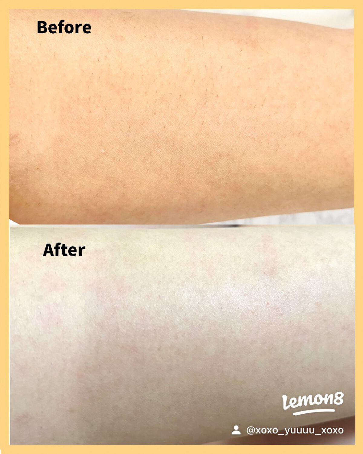 ボディーシェーバー 2IN1/ANLAN/シェーバーを使ったクチコミ(5枚目)