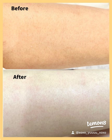 ボディーシェーバー 2IN1/ANLAN/シェーバーを使ったクチコミ(5枚目)