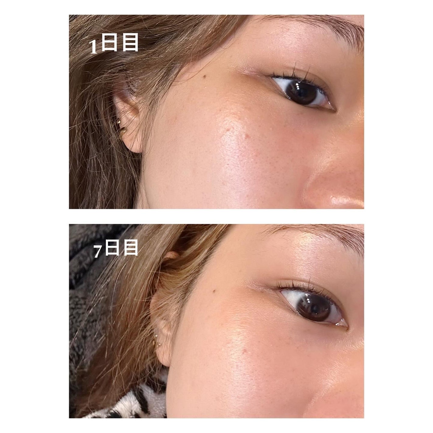 シカレチA エッセンス0.7/VT/美容液を使ったクチコミ(4枚目)