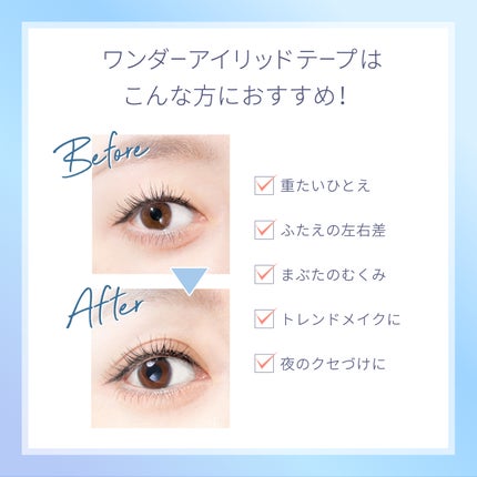 ワンダーアイリッドテープ Extra/D-UP/二重まぶた用アイテムを使ったクチコミ(2枚目)
