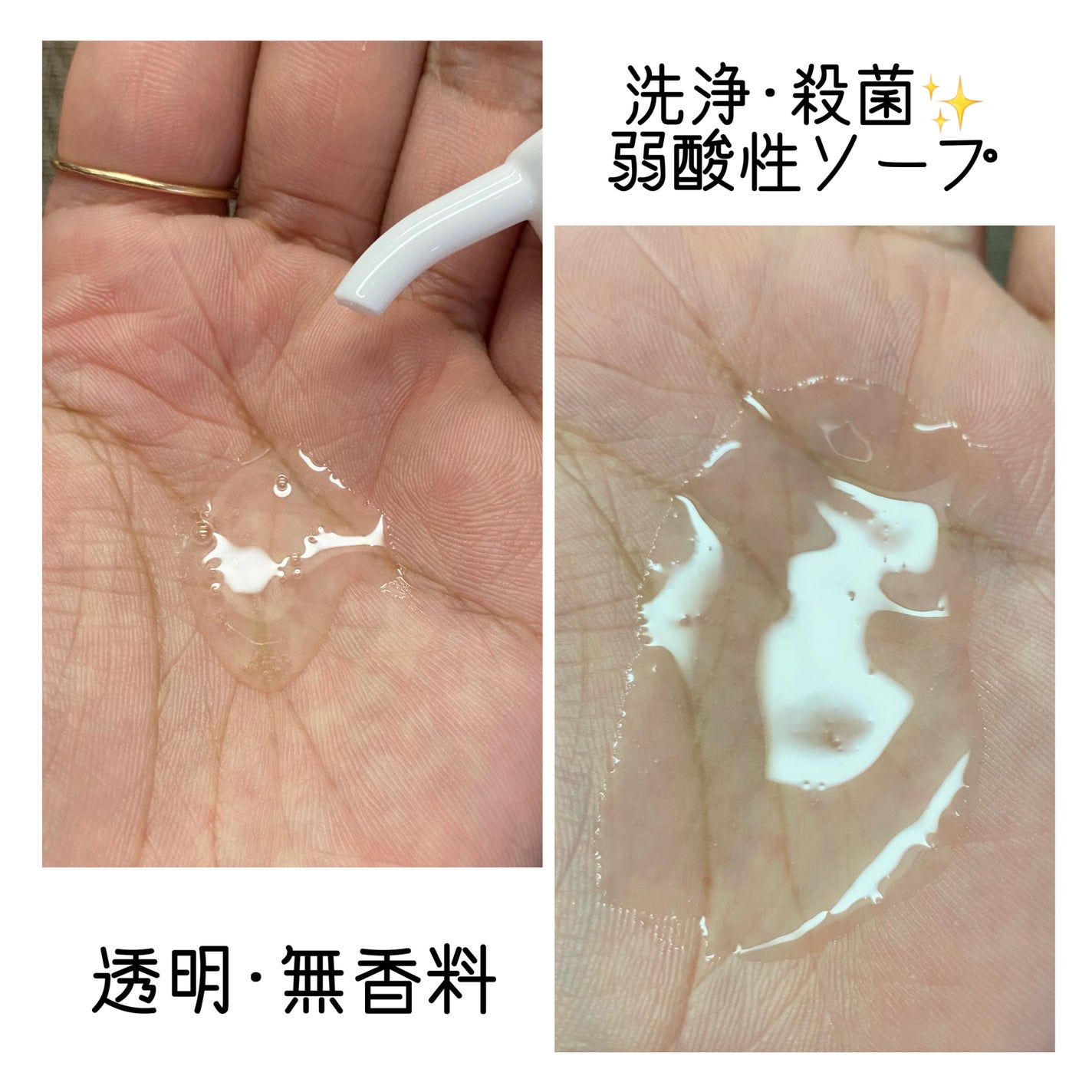 薬用マイルドケアウォッシュ/DELIWHITE/デリケートゾーンケアを使ったクチコミ(3枚目)