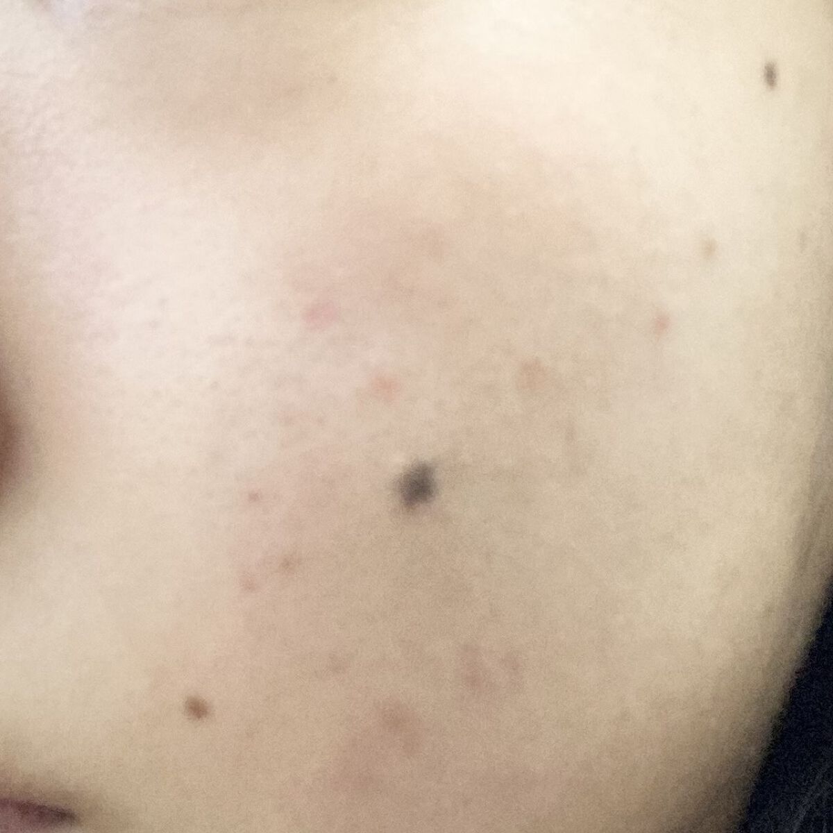 RXザ・レチノール0.1クリーム/COSRX/フェイスクリームを使ったクチコミ（3枚目）