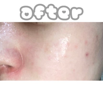 ミュゲナーアンプルマスク/CNP Laboratory/シートマスク・パックを使ったクチコミ(5枚目)