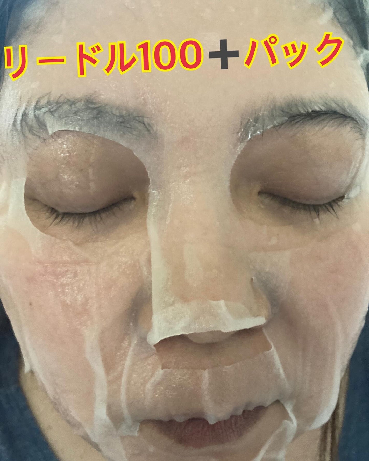 リードルS 300 2ステップマスク/VT/シートマスク・パックを使ったクチコミ(6枚目)