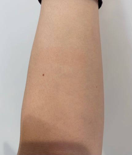 ãã€ã«ãã¯ã¬ã³ãžã³ã° ãªã€ã«ããã©ãã¯ïŒã¹ã ãŒã¹ã/ãã¡ã³ã±ã«/ãªã€ã«ã¯ã¬ã³ãžã³ã°ã䜿ã£ãã¯ãã³ãïŒ5æç®ïŒ