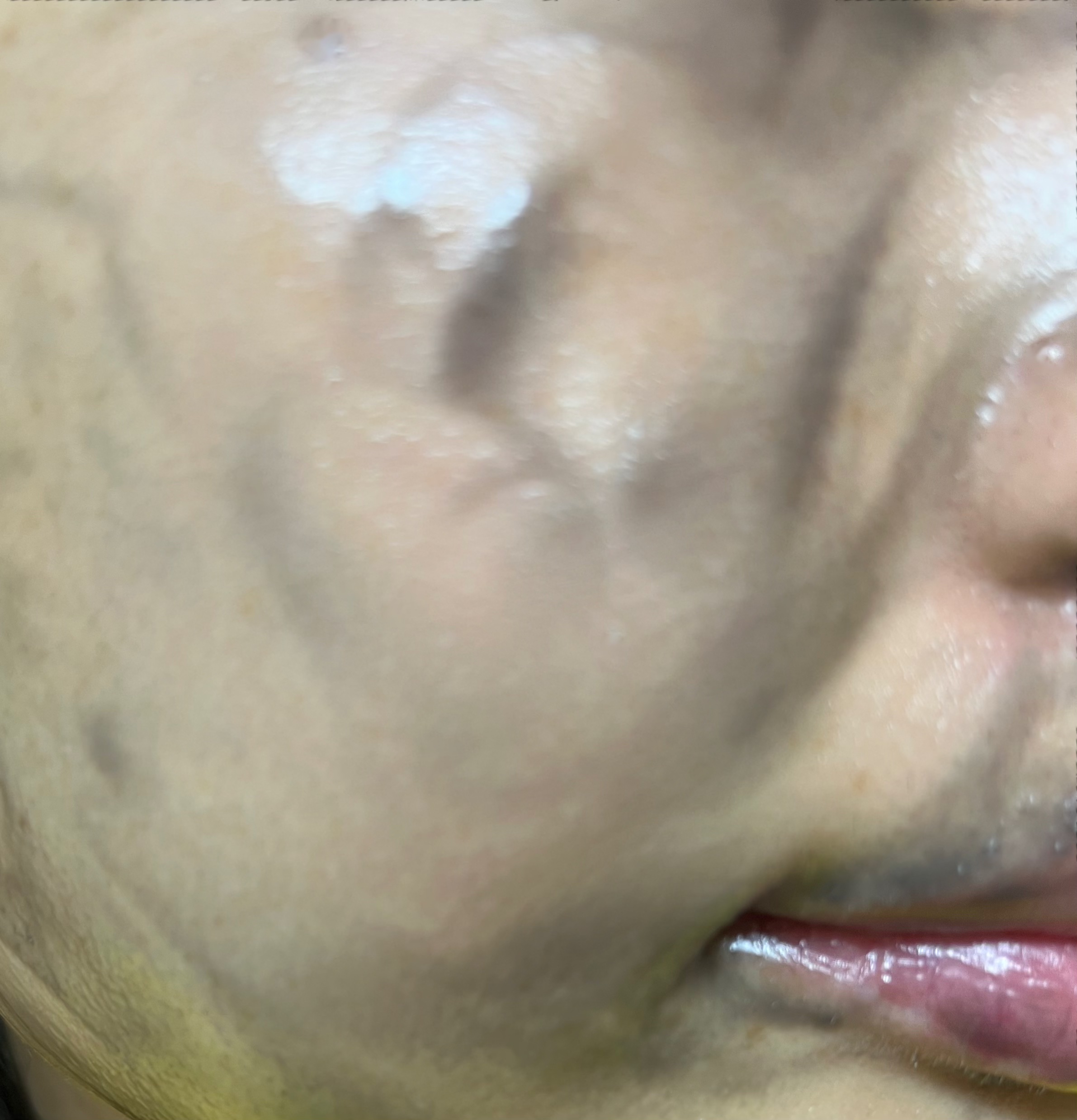 ソフティモ クリアプロ クレンジングバーム CICA ブラック/ソフティモ/クレンジングバームを使ったクチコミ（3枚目）