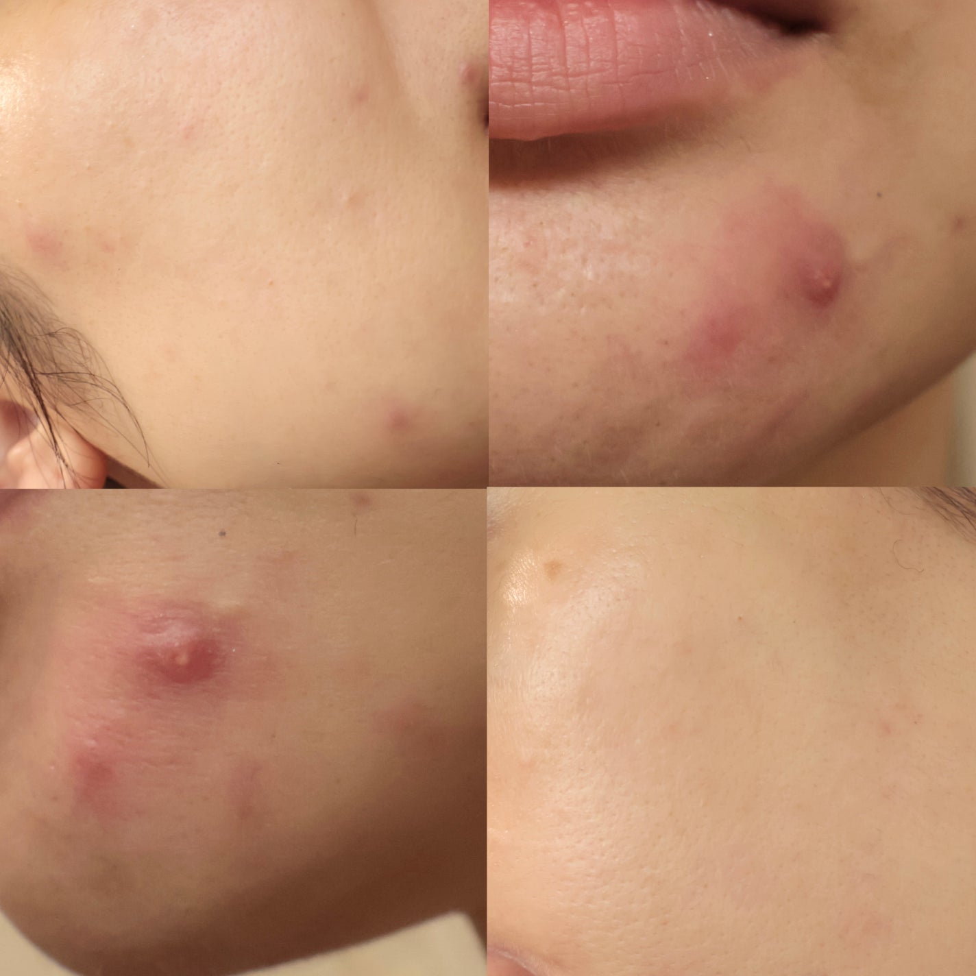 mina___85 on LIPS 「【最強のビタミンA】皮膚科でしか処方されない最強レチノール「ト..」(7枚目)