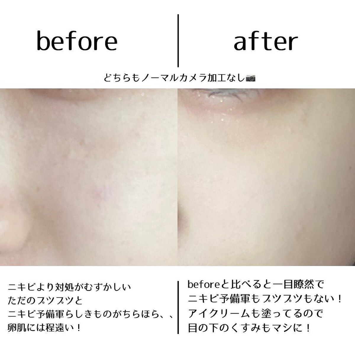 メディカルクリームG(薬用クリームG)/メンターム/ハンドクリームを使ったクチコミ(2枚目)