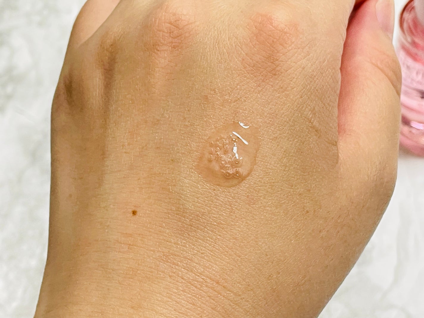 ピンクティーツリートナー/APLIN/化粧水を使ったクチコミ(5枚目)