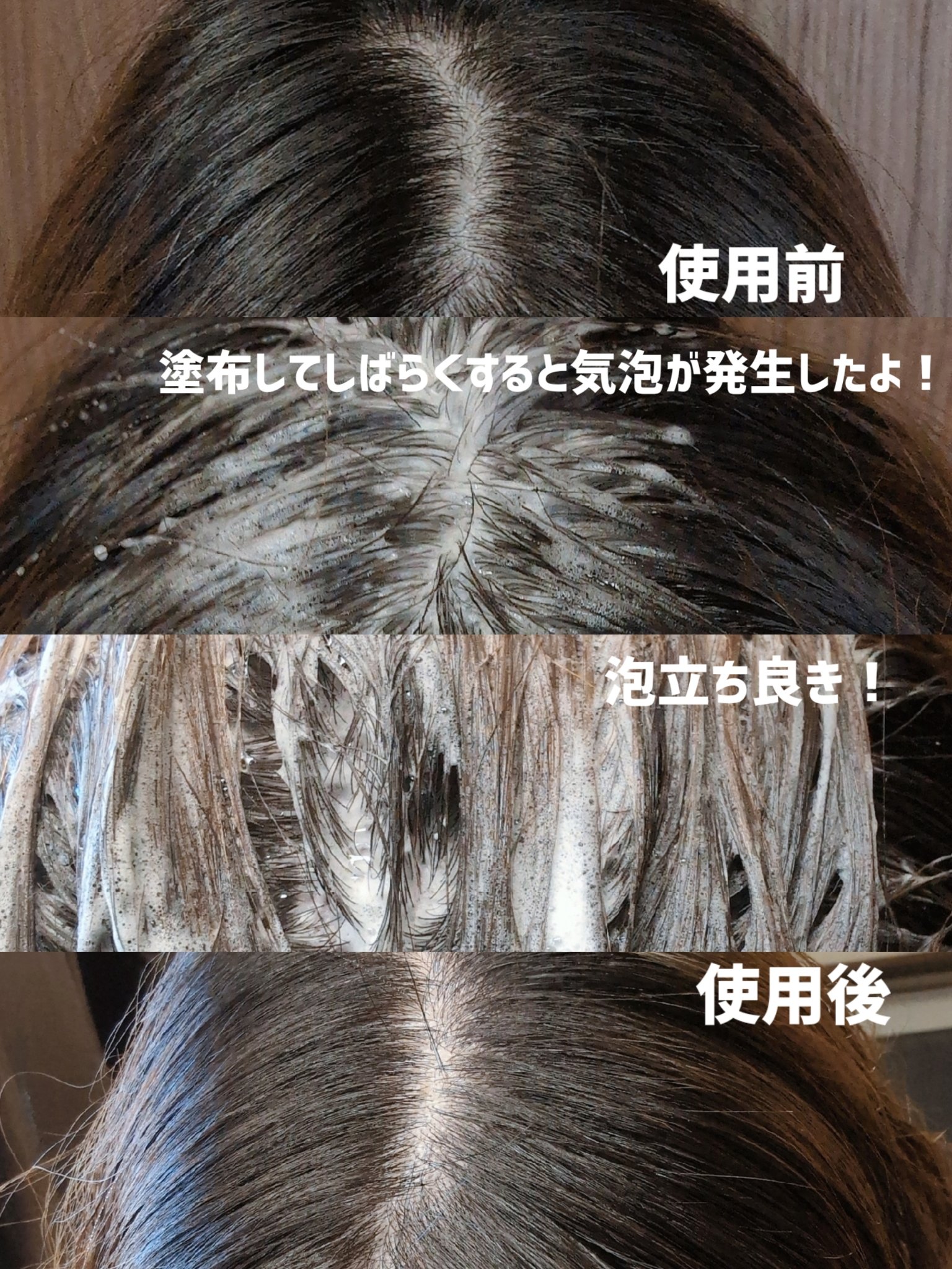 スパークリングスカルプスケーラー/ミンツリー/頭皮ケアを使ったクチコミ（2枚目）