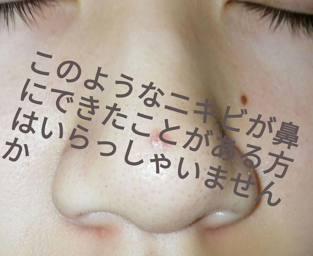 極潤 ヒアルロン液 ライトタイプ/肌ラボ/化粧水を使ったクチコミ（1枚目）