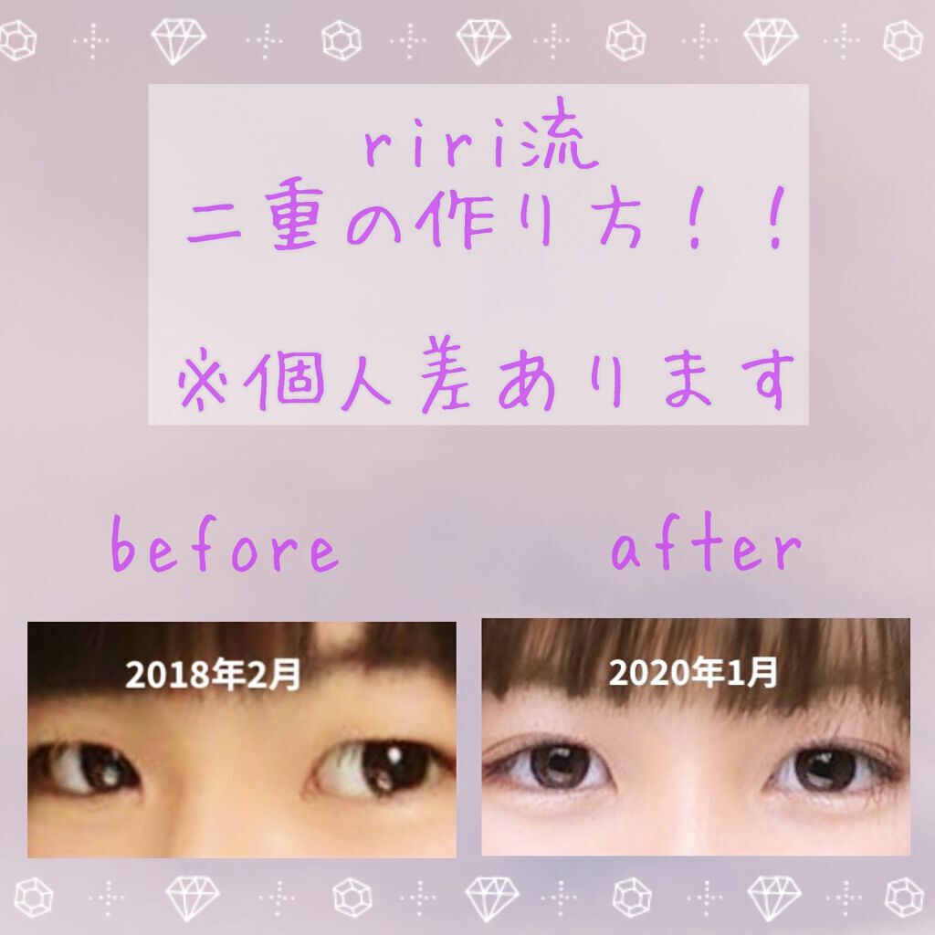 ダブルアイリッド/DAISO/二重まぶた用アイテムを使ったクチコミ（1枚目）