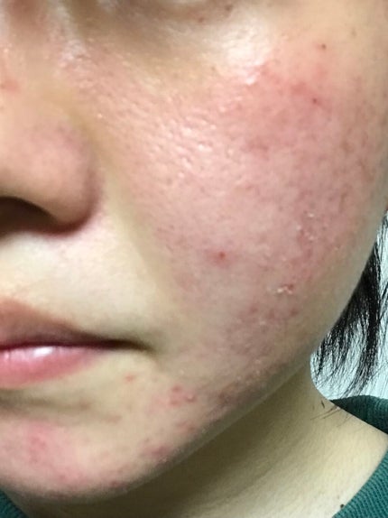 ãšããã¥ãªã²ã«/ãã«ãæ ªåŒäŒç€Ÿ/ãã®ä»ã䜿ã£ãã¯ãã³ãïŒ2æç®ïŒ