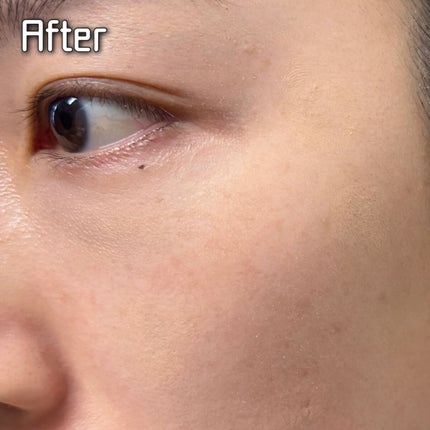 マスクフィットオールカバーデュアルコンシーラー/TIRTIR(ティルティル)/コンシーラーを使ったクチコミ(7枚目)