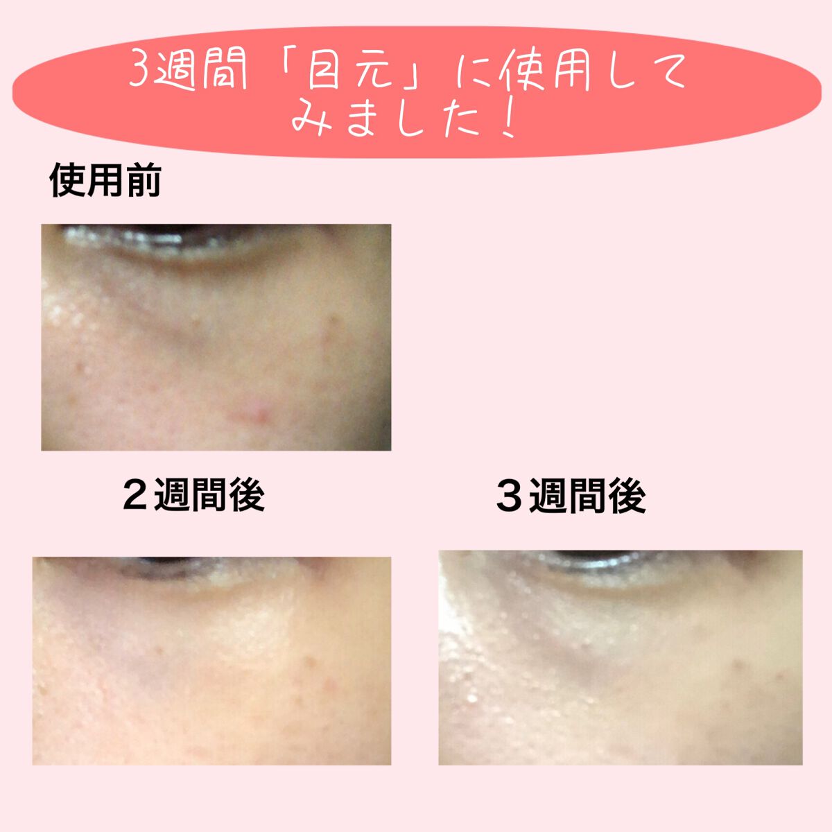 サーモウェイブアイリフト/Makeon/美顔器・マッサージを使ったクチコミ(3枚目)