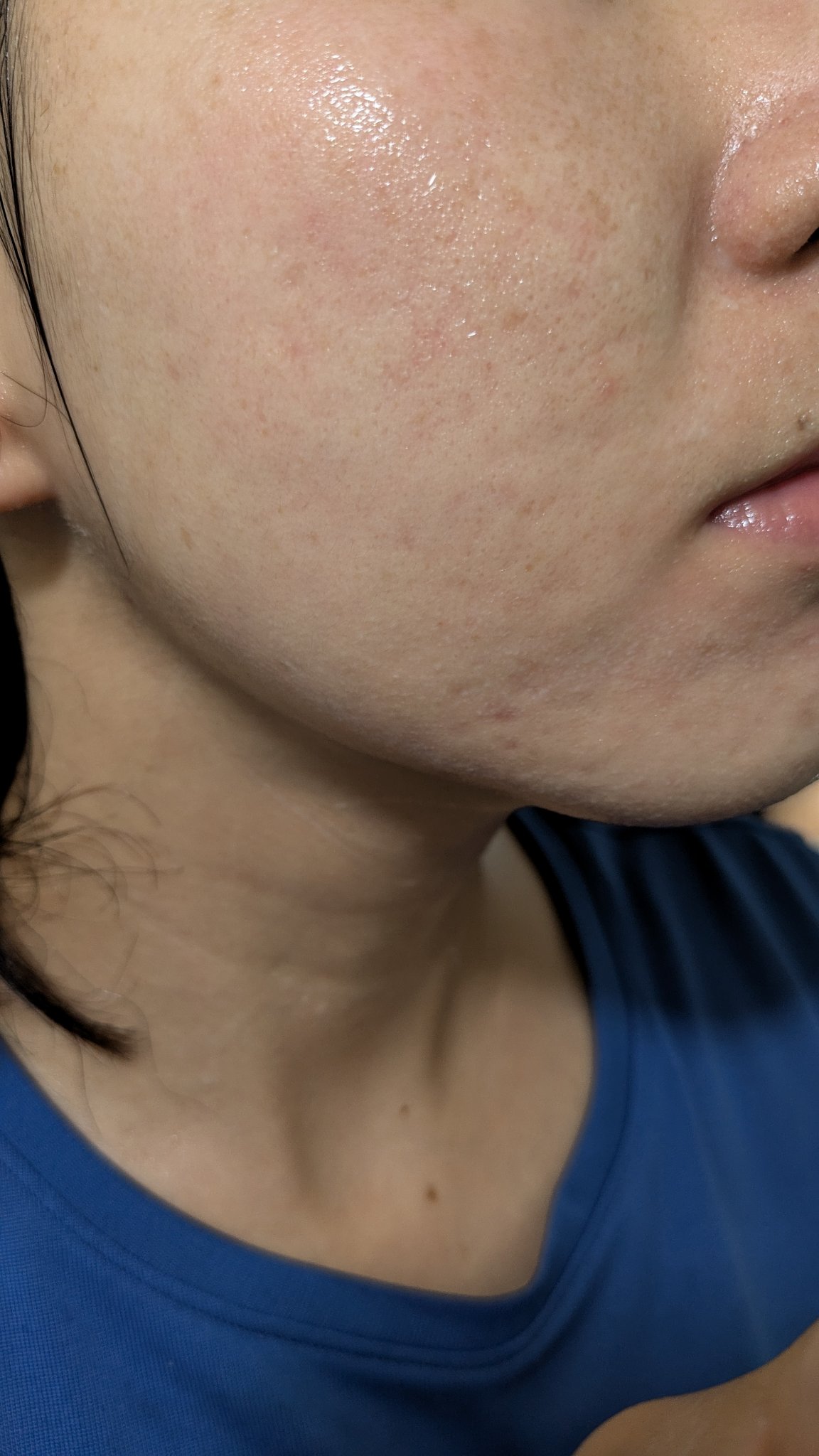 A2+NAG2ソリューション/The Ordinary/美容液を使ったクチコミ（1枚目）