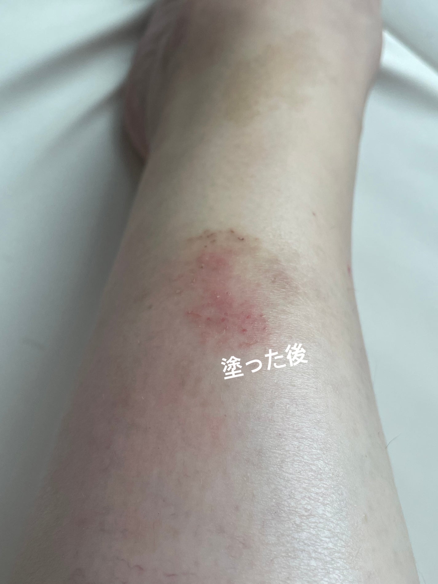 ドクターバリアATOピーエスエルローション/Dr.Barrier/化粧水を使ったクチコミ(4枚目)