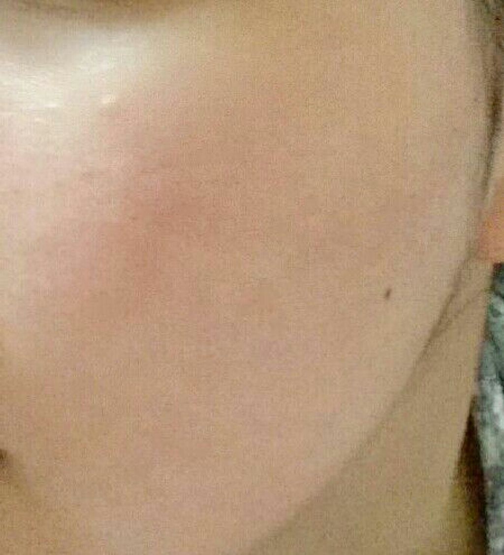 あみ on LIPS 「前よりも確実に肌綺麗になった。..」(1枚目)