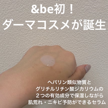 アンドビー 薬用アクネケアセラム【医薬部外品】/&be/美容液を使ったクチコミ(2枚目)
