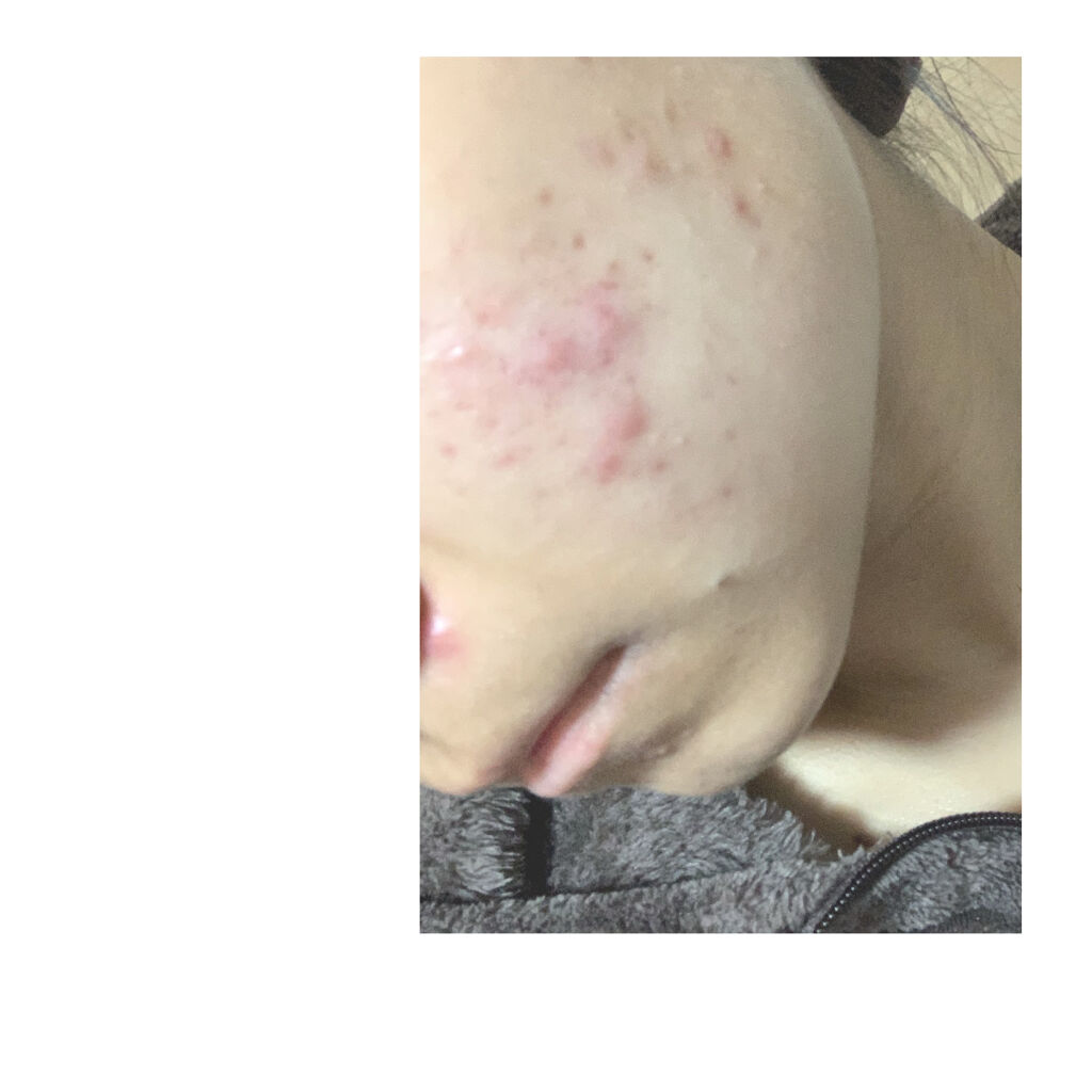 クリアウォッシュ/オルビス/洗顔フォームを使ったクチコミ（2枚目）