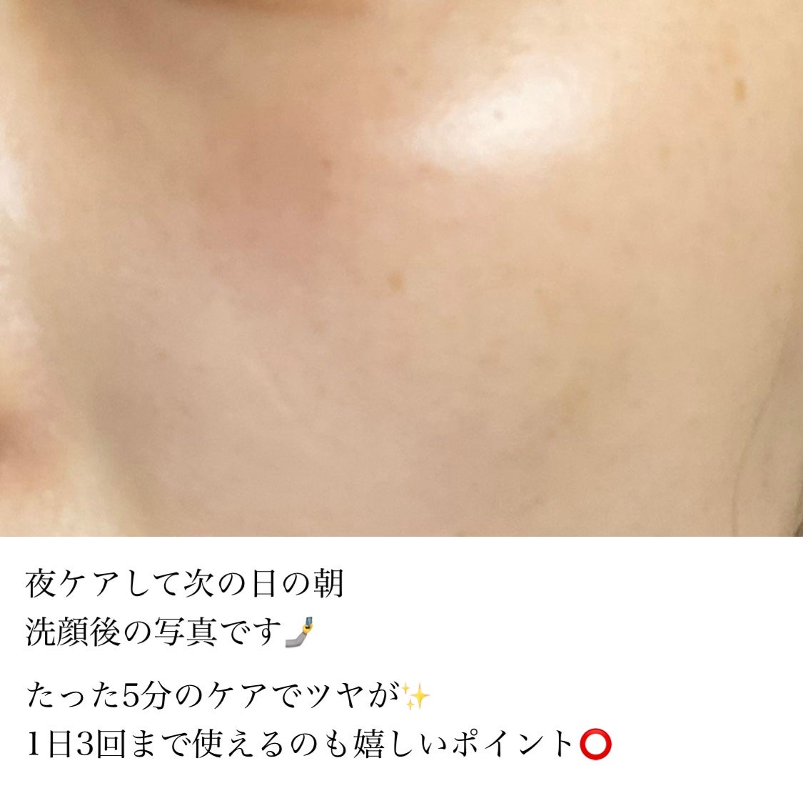 AGE-Rスキンブースターショット/MEDICUBE/美顔器・マッサージを使ったクチコミ(3枚目)