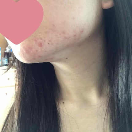 アロエ99% スージングジェル/HOLIKA HOLIKA/ボディローションを使ったクチコミ(2枚目)