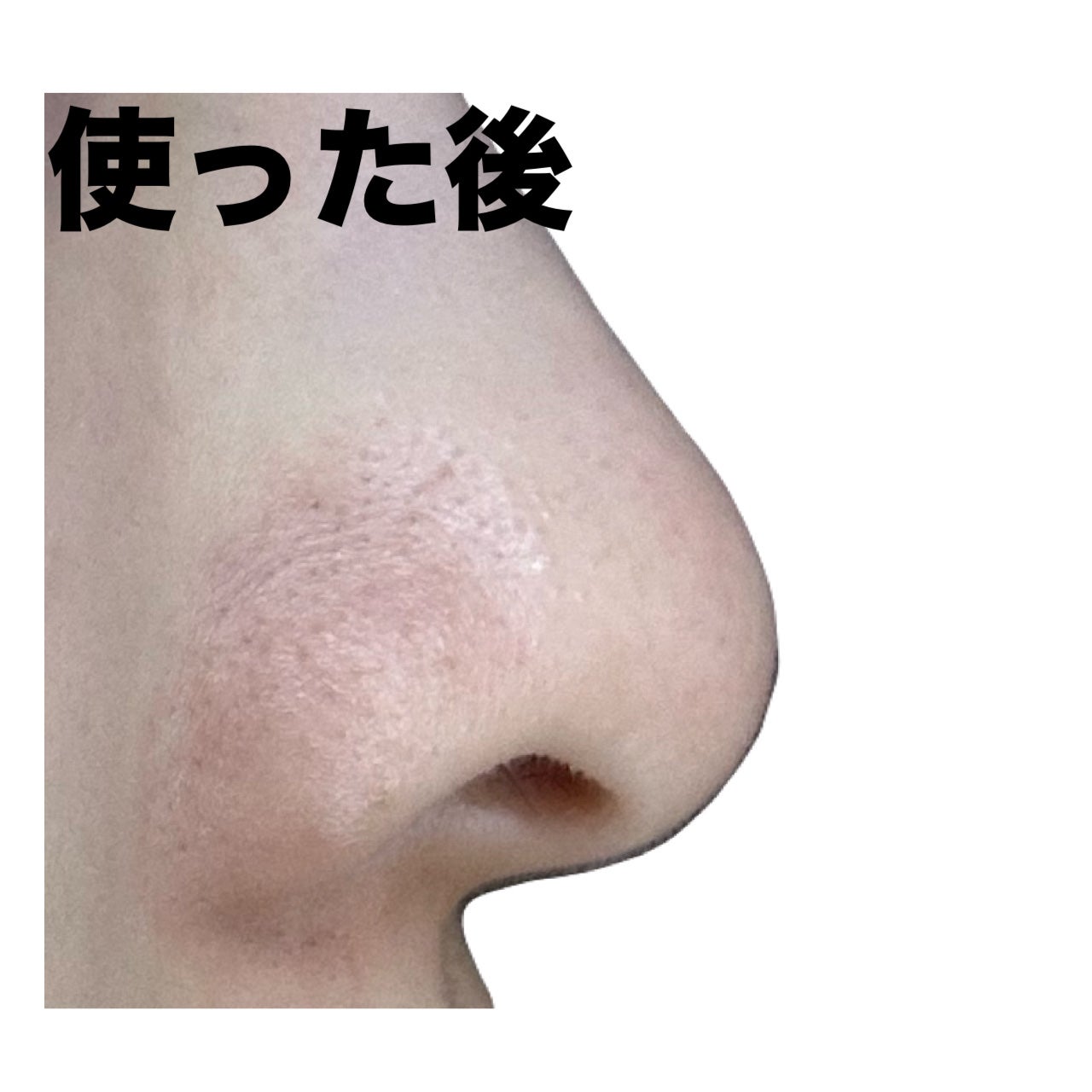 ノーズピーリングパック/One-day's you/シートマスク・パックを使ったクチコミ(7枚目)