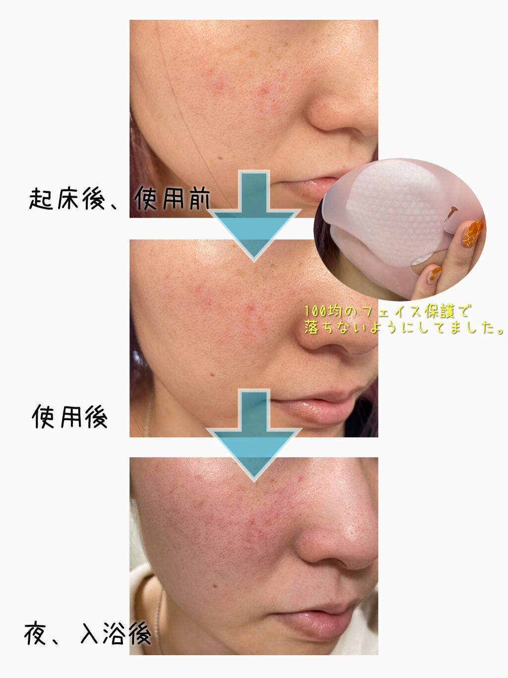 CICA マイルドトナーパッド/VT/トナーパッドを使ったクチコミ(4枚目)