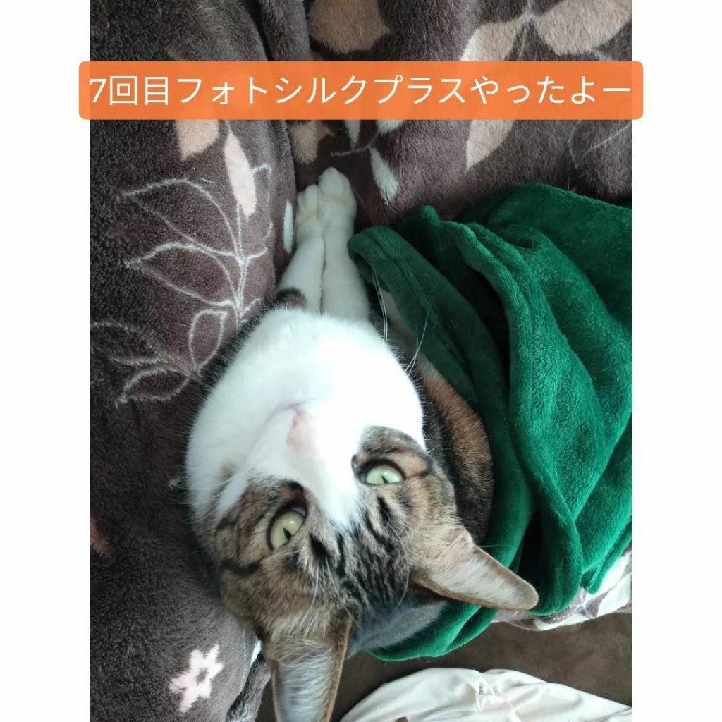 あにゃにゃ♡フォロバ100♡ on LIPS 「7回目のフォトシルクプラス後1週間の変化🙌※去年の8月から品川..」(1枚目)