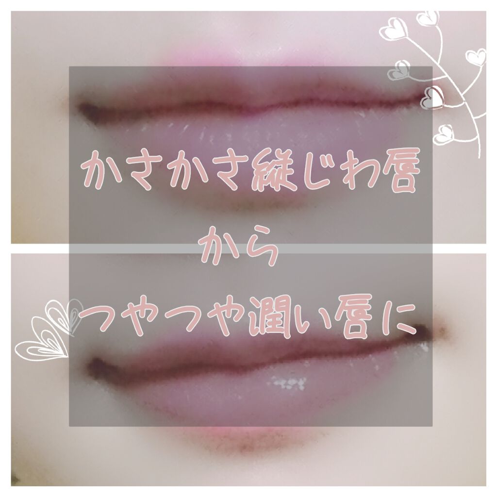 コンディショニングリップセラム/Blistex/リップクリームを使ったクチコミ(1枚目)