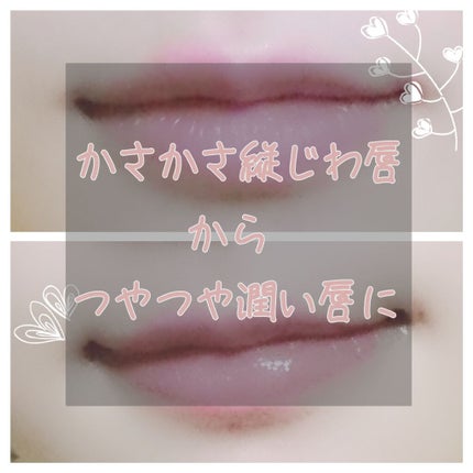 コンディショニングリップセラム/Blistex/リップクリームを使ったクチコミ(1枚目)